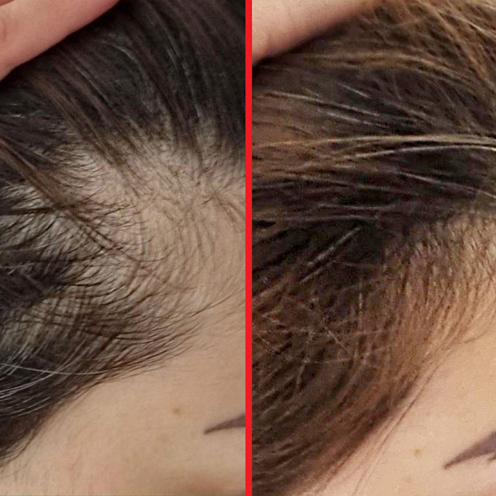 سرم مو ضد ریزش هیرتامین مدل gorgeous growth scalp