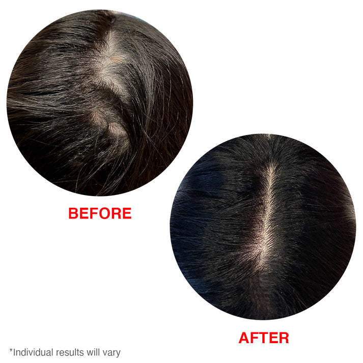 سرم مو ضد ریزش هیرتامین مدل gorgeous growth scalp