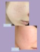 ماسک روشن کننده تاچا مدل violet c
