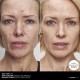 کرم مرطوب کننده اینکی لیست مدل peptide