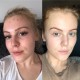 تونر لایه بردار اوردینری glycolic acid 7%