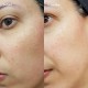 سرم لایه بردار اوردینری مدل lactic acid