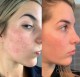 سرم لایه بردار اوردینری مدل lactic acid