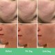 سرم لایه بردار اوردینری مدل lactic acid