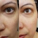 سرم رتینول اوردینری Retinol