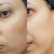 سرم رتینول اوردینری Retinol