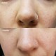 سرم رتینول اوردینری Retinol