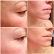 سرم آبرسان و جوانساز اوردینری مدل Multi Peptide + HA (buffet)
