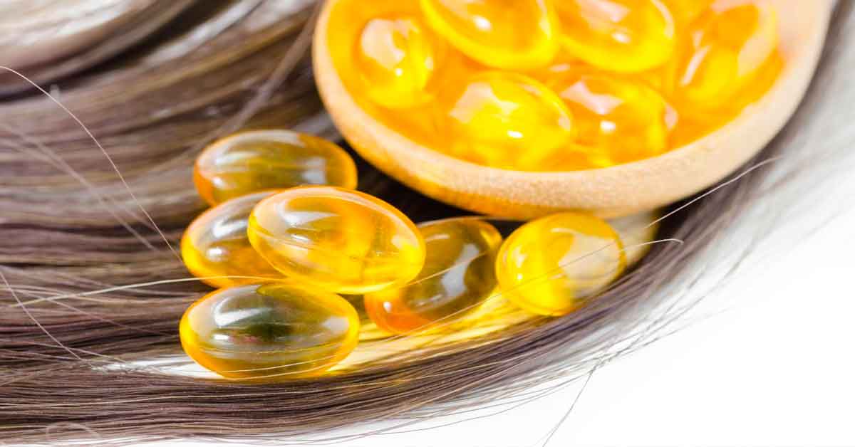 آیا کمبود ویتامین D می تواند باعث ریزش مو شود؟