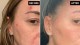 سرم کلاژن پپتید اینکی لیست Collagen peptide