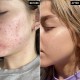سرم نیاسینامید اینکی لیست NIACINAMIDE