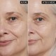کرم دور چشم رتینول اینکی لیست retinol