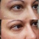 کرم دور چشم رتینول اینکی لیست retinol