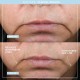 دستگاه لیفتینگ صورت نوفیس مدل Facial Toning