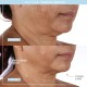 دستگاه لیفتینگ صورت نوفیس مدل Facial Toning