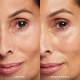 ست مراقبت از پوست اوله هنریکسن مدل After Party Peptides