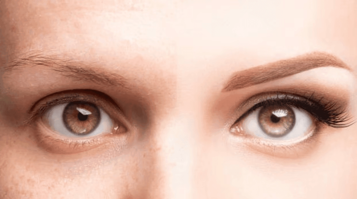 هر آنچه که باید در مورد میکروبلیدینگ ابرو بدانید