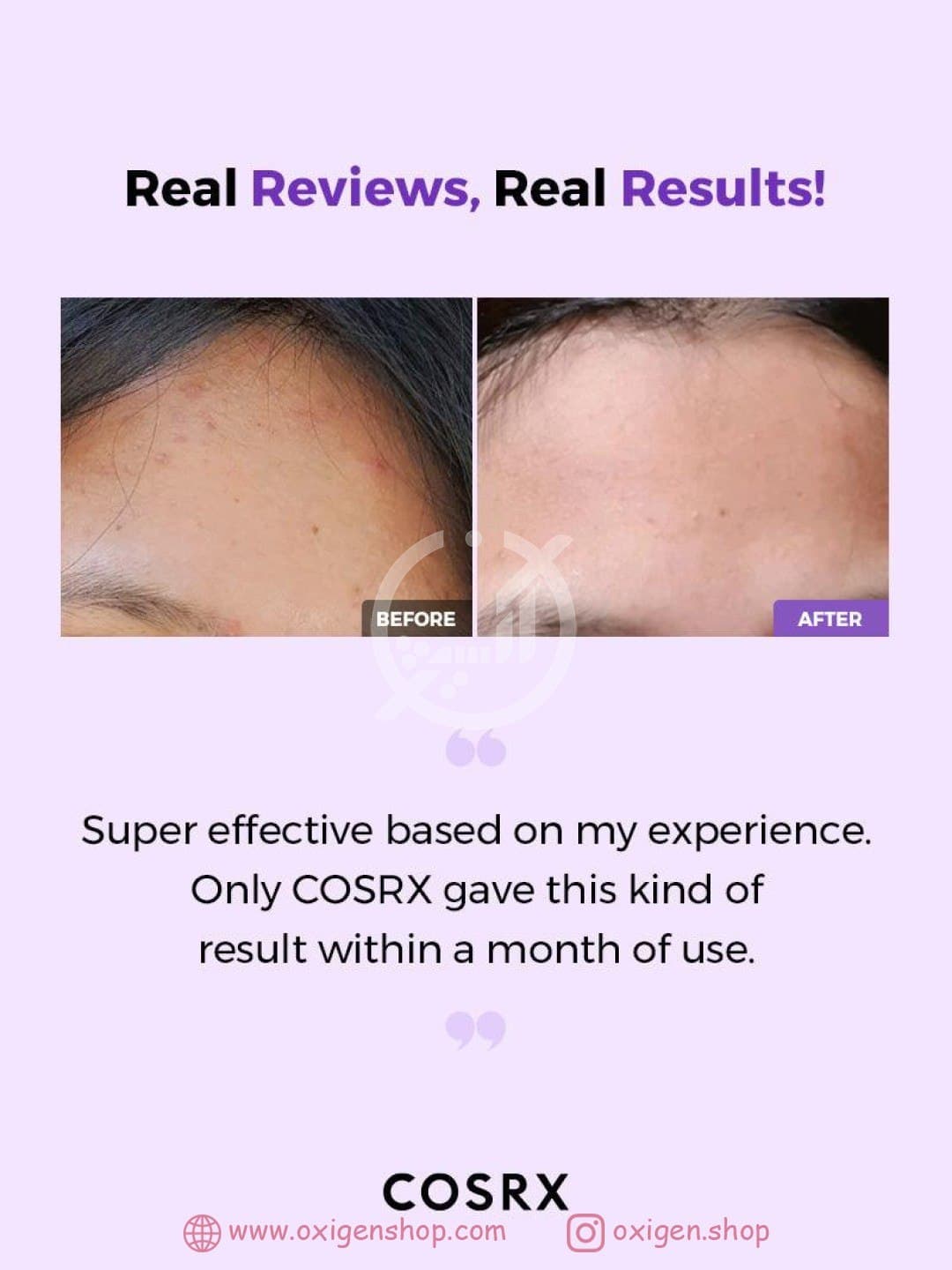 تونر شفاف کننده کوزارکس مدل AHA/BHA تونر شفاف کننده کوزارکس مدل AHA/BHA