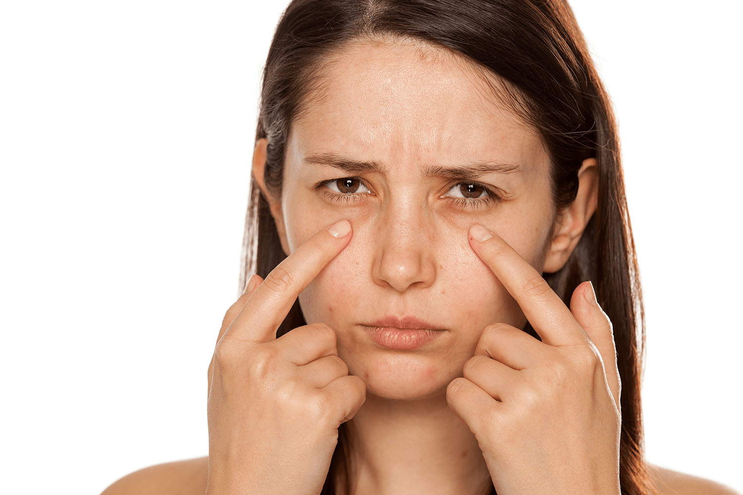 چگونه پف زیر چشم را کاهش دهیم؟