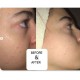 سرم روشن کننده اوردینری مدل Ascorbyl Glucoside 12%