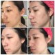 سرم روشن کننده اوردینری مدل Ascorbyl Glucoside 12%